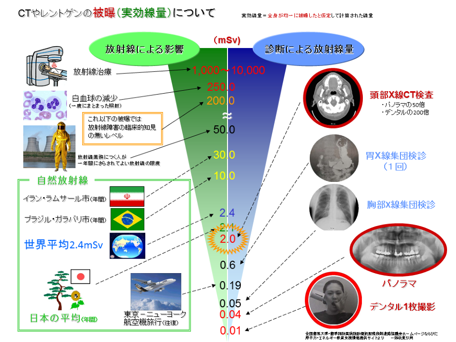 デジタルレントゲン検査