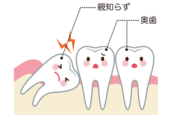 口腔外科（抜歯について）
